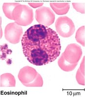 Eosinophil blood smear