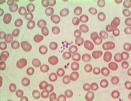 Platelets under microscope