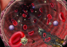 Hemostasis steps: vascular spasm, platelet plug, coagulation