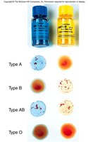 Blood typing procedure and results