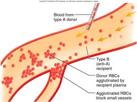 Transfusion reaction: agglutinated RBCs block vessels