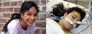 Jesica Santillan before and after transplant