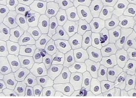 Simple squamous epithelium