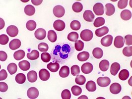 Neutrophil under microscope