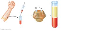 Blood sample centrifugation showing plasma, buffy coat, and erythrocytes