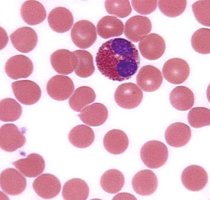 Eosinophil under microscope