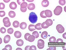 Lymphocyte under microscope