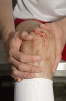 Hemostasis steps