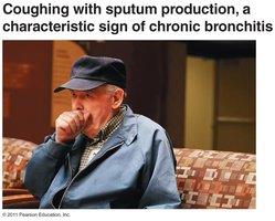 Coughing with sputum in chronic bronchitis