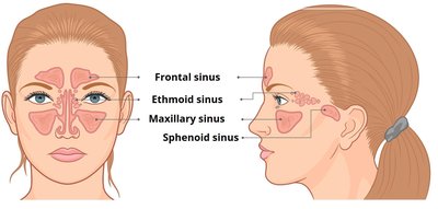Locations of the paranasal sinuses