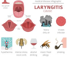 Causes of laryngitis