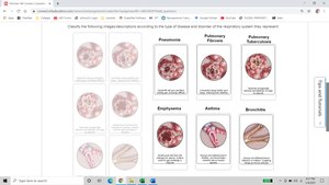 Pleural membranes and cavity