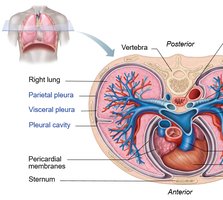 Normal vs. inflamed pleura