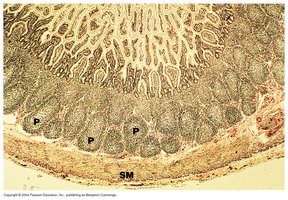 Histological section of Peyer's patches in the small intestine