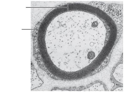 Electron micrograph of myelinated axon