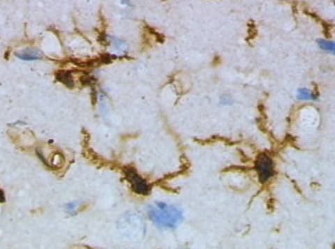 Ependymal cells lining brain ventricles