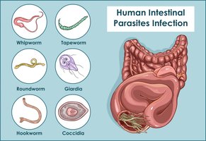 Human intestinal parasites: whipworm, tapeworm, roundworm, giardia, hookworm, coccidia