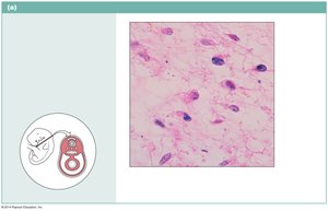Mesenchymal tissue, embryonic connective tissue