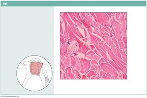 Dense irregular connective tissue in dermis