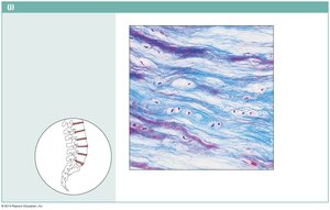 Fibrocartilage in intervertebral disc