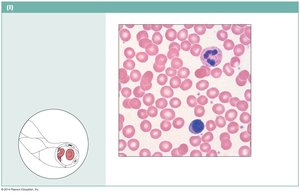 Blood smear with red and white blood cells