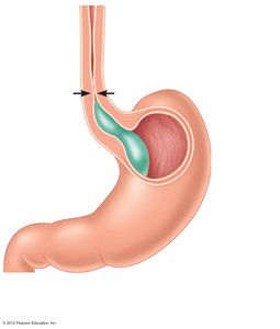 Diagram showing swallowing and movement of bolus through esophagus and sphincters