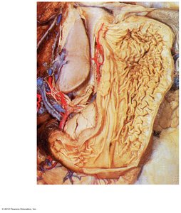 Dissected view of the stomach showing rugae