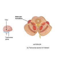 Transverse section of midbrain showing reticular formation