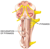 Decussation of pyramids in the medulla oblongata