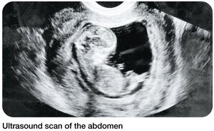 Ultrasound scan of the abdomen