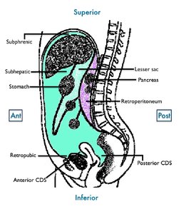 Sagittal view of abdominal spaces