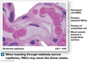 RBCs stacking in capillaries (rouleaux)
