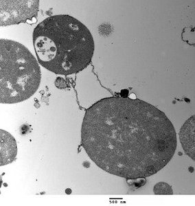 Electron micrograph of L-form bacteria
