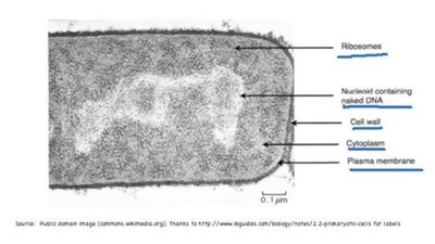 Electron micrograph of a prokaryotic cell with labeled structures