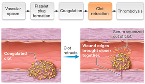 Clot Retraction Process Anatomy & Physiology Blood Study Guide | Key Concepts | Notes