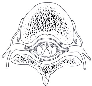 Transverse cross section of spinal cord with nerves and vertebrae