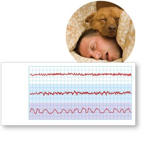 EEG patterns during sleep states