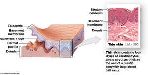 Diagram of thin skin structure
