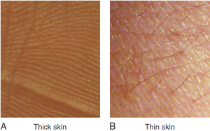 Comparison of thick and thin skin under magnification