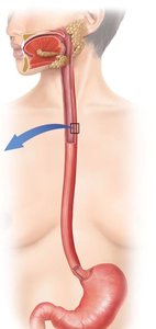 Diagram showing the esophagus and its connection to the stomach