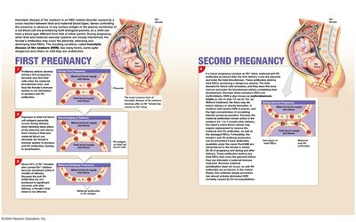 Hemolytic disease of the newborn