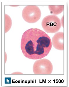Eosinophil under microscope