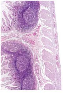 MALT in the oral cavity and intestines