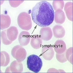 Blood smear showing monocyte and lymphocyte