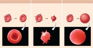 Effects of isotonic, hypertonic, and hypotonic solutions on red blood cells