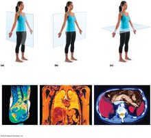 Body planes with corresponding MRI scans