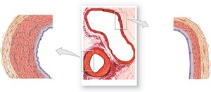 Comparison of artery and vein wall structure