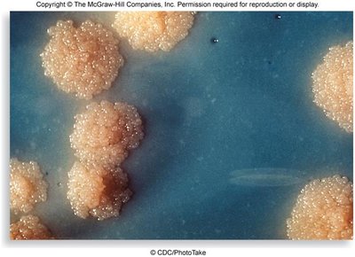 Colony morphology of Mycobacterium tuberculosis on culture