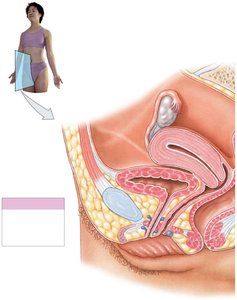 Sagittal section of female pelvis showing reproductive organs