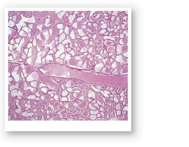 Histological section of mammary gland
